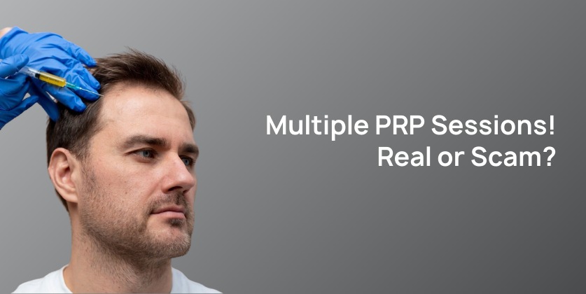 The Truth About Multiple Unnecessary PRP Sessions After Transplant