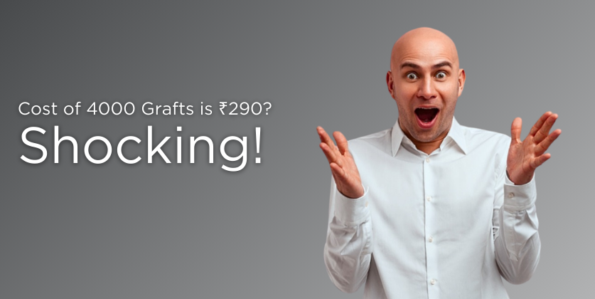 What Is the Cost of 4000 Grafts in Hair Transplant?