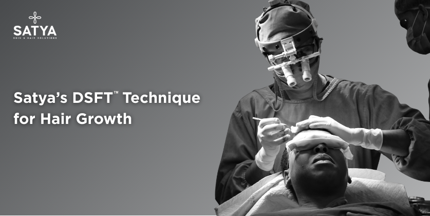 Revolutionizing Hair Transplants: Why DSFT™ Stands Out