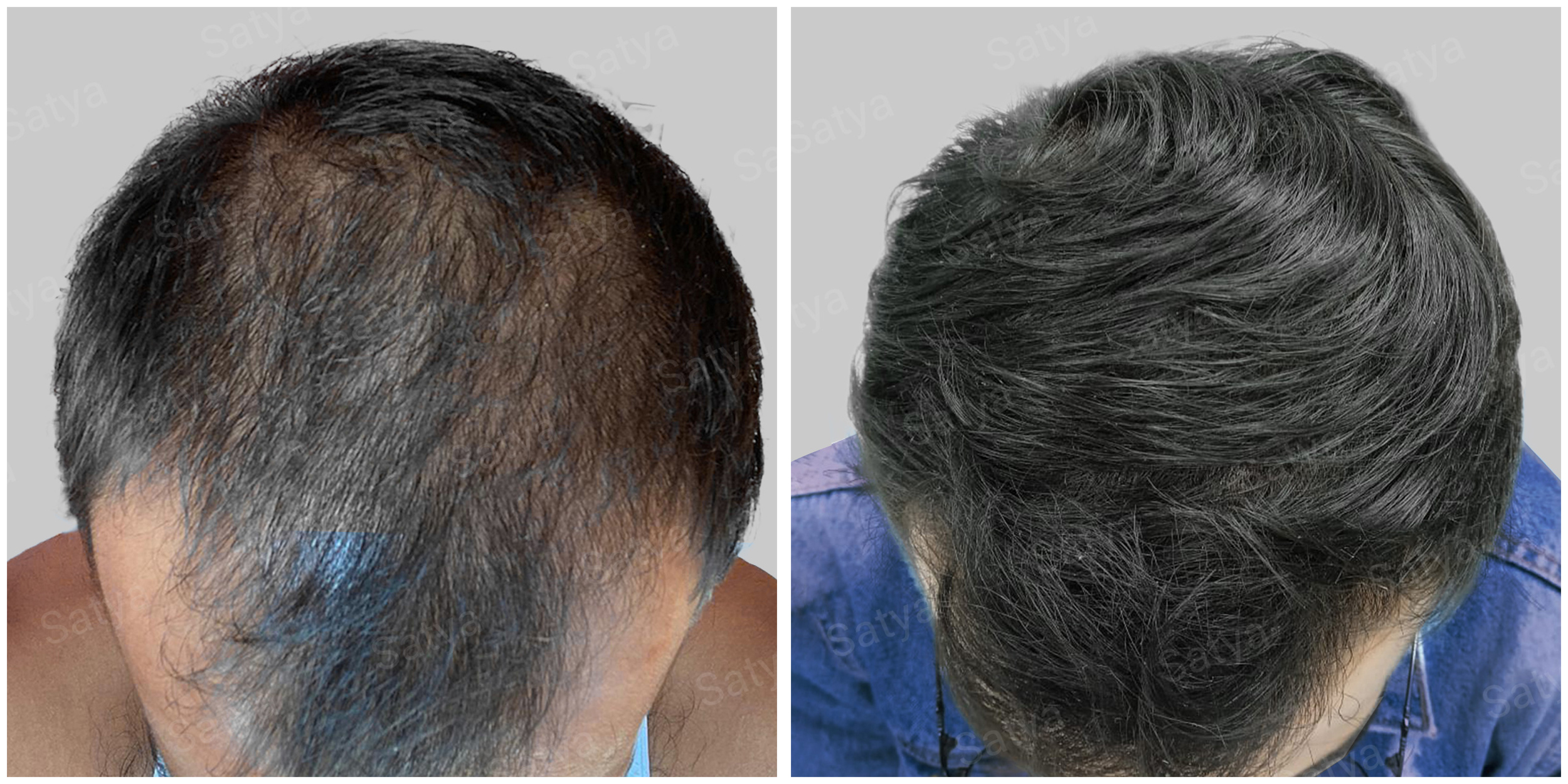 Medical Treatment Before & After Photos