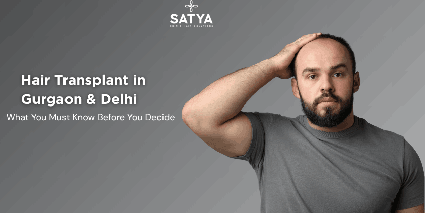 Hair Transplant in Gurgaon & Delhi: What You Must Know Before You Decide
