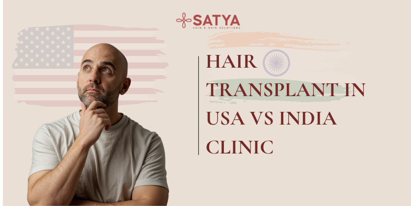 Hair Transplant in USA vs India