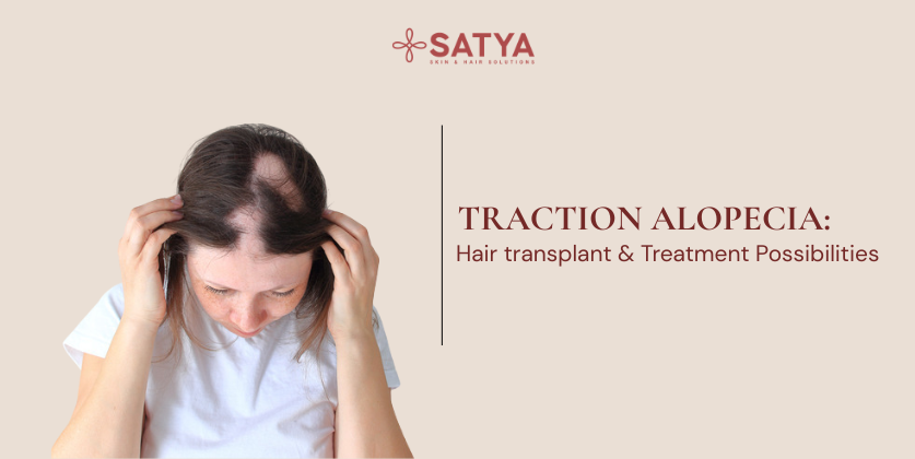 Traction Alopecia
