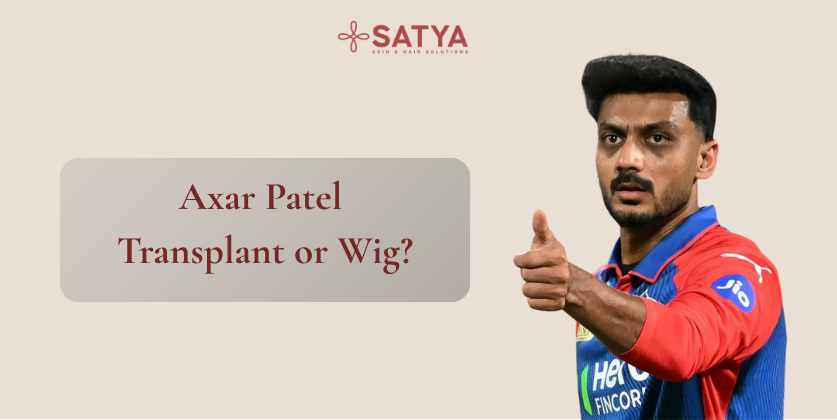 Did Axar Patel Get a Hair Transplant? Celebrity Hair Transplants Explained