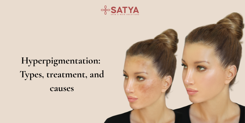 Hyperpigmentation