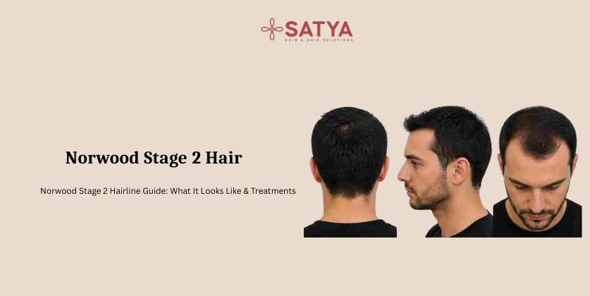 Norwood Stage 2: What It Means, What It Looks Like, and What to Do Now