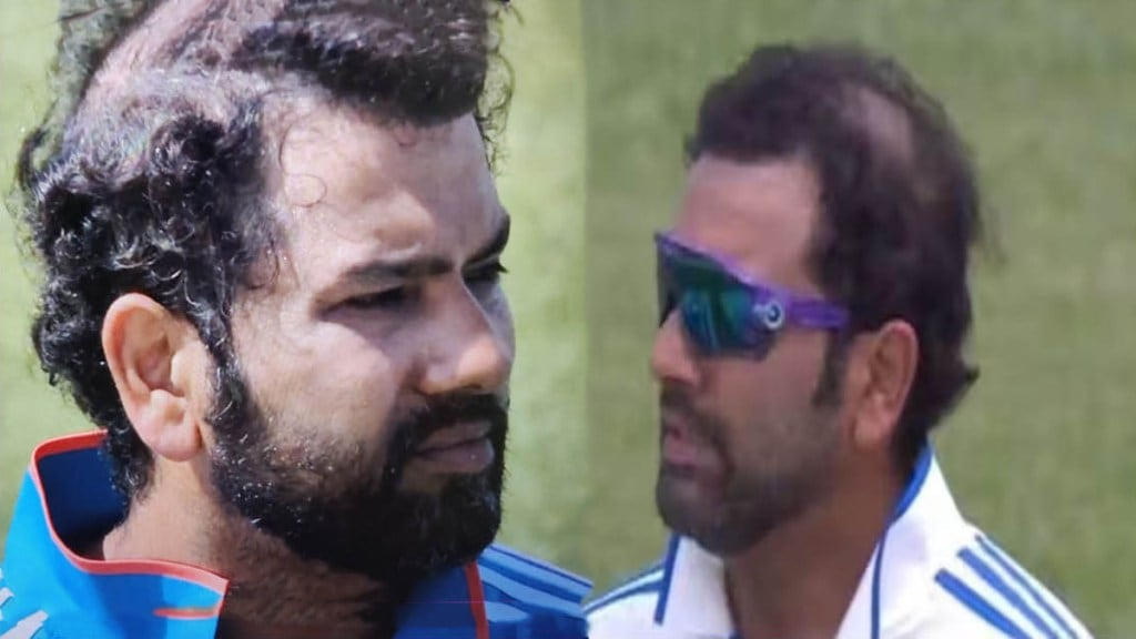 Rohit Sharma hair fall