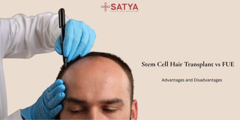 Stem Cell Hair Transplant vs FUE