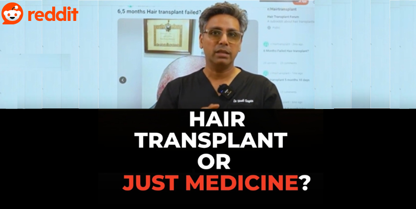 3,300 Grafts vs Medicine Alone: What Actually Grew the Hair?