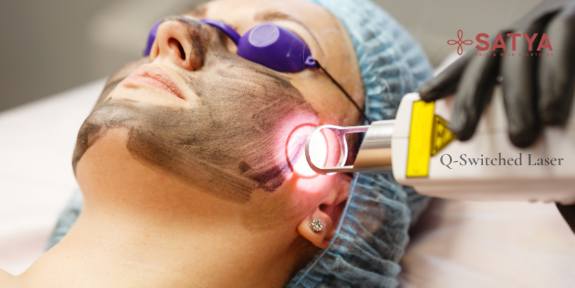 Q-Switched Laser for Pigmentation: How It Works and How Many Sessions You Need