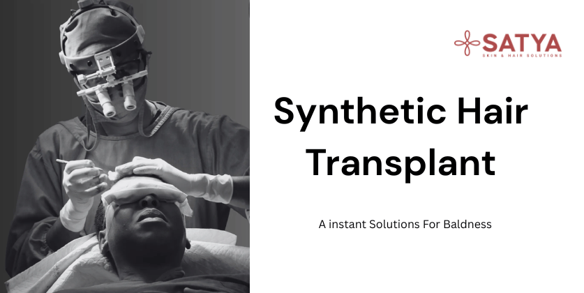 Synthetic Hair Transplant