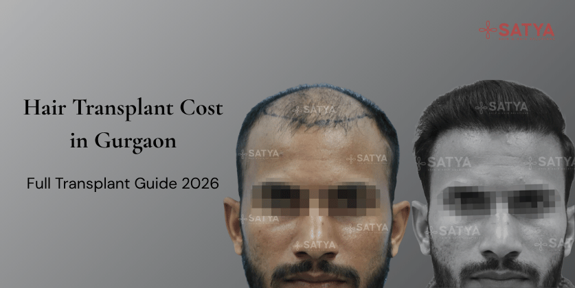 Hair Transplant Cost in Gurgaon: A Doctor’s Honest Price Guide (2026)